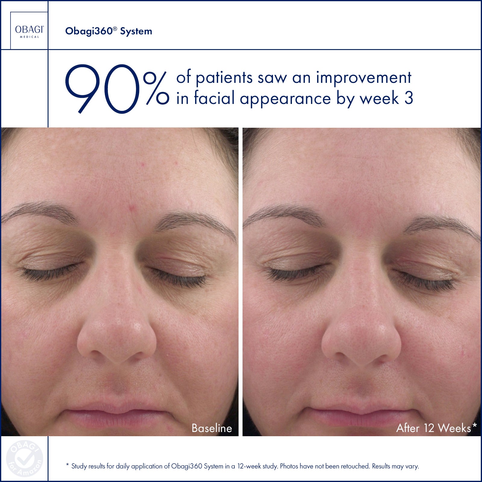 Obagi Medical Obagi360 System Kit (3 piece) - The Look and Co