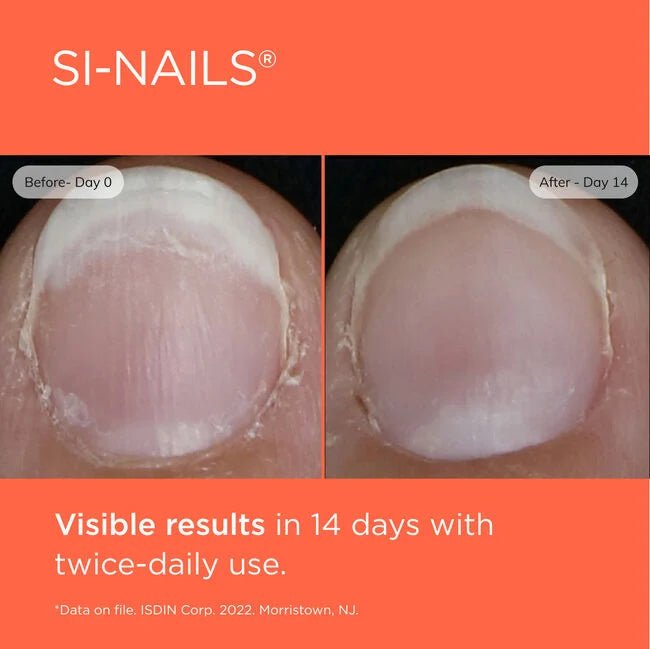 Si-Nails - The Look and Co