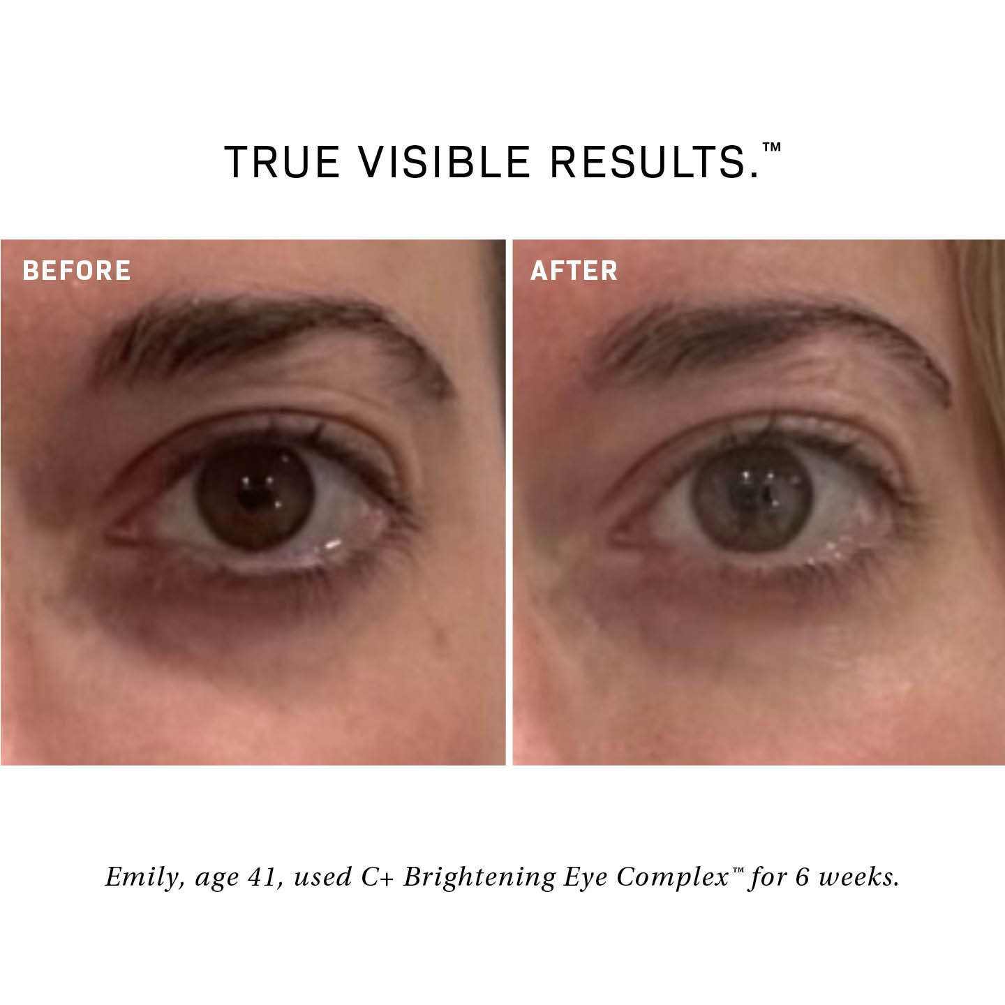 C+ Brightening Eye Complex™ - The Look and Co