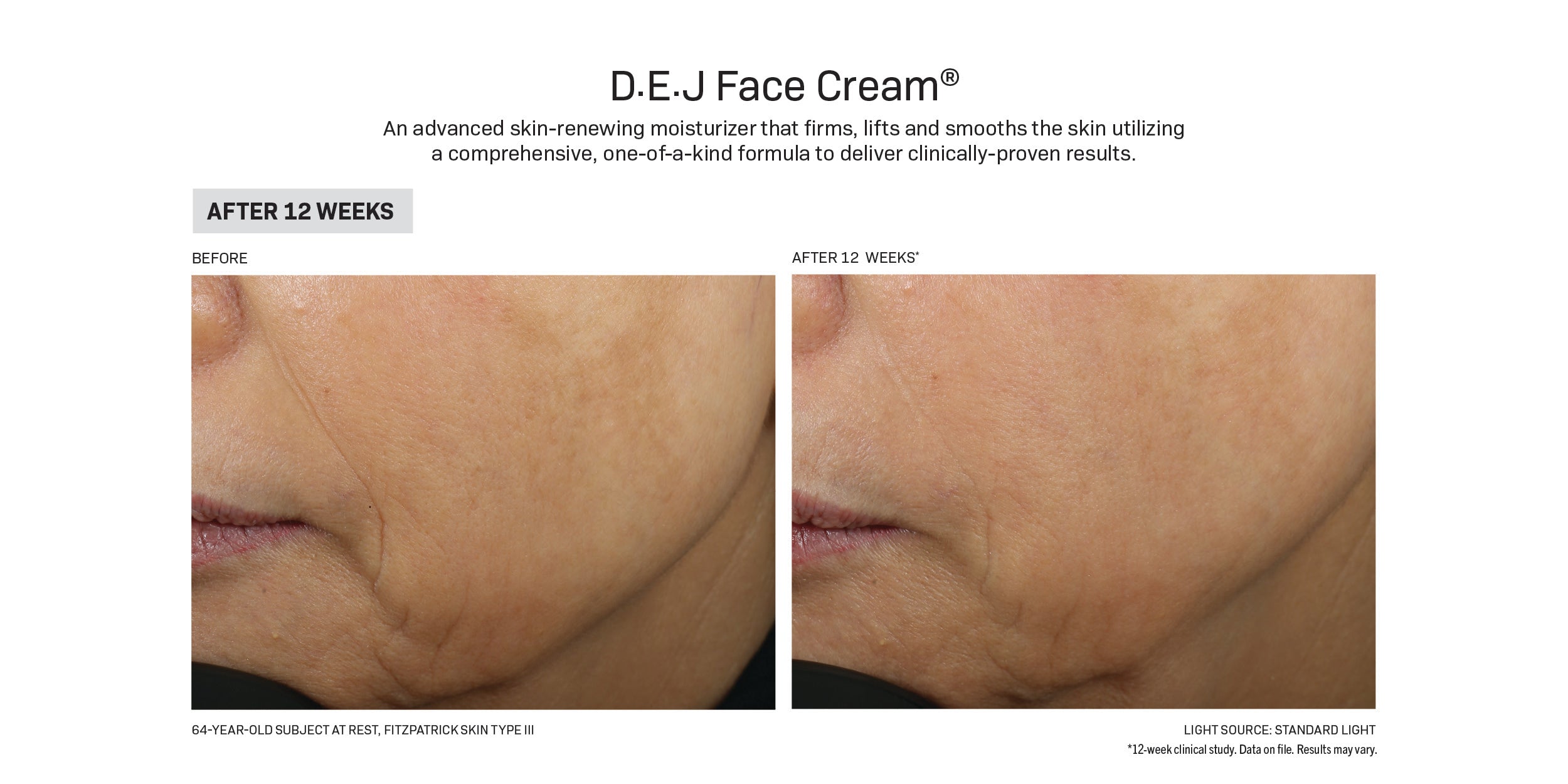 D.E.J Face Cream®